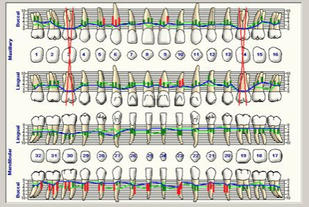 periodontal charting Philadelphia PA