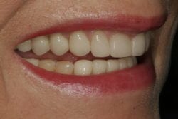 Meg right smile after cropped IMG_3683