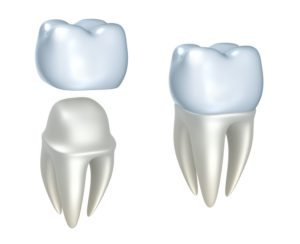advantages with dental crowns Philadelphia Pennsylvania