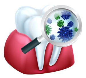 oral bacteria and preventative dentistry