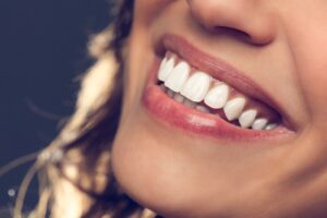 Why Your Teeth Need Calcium