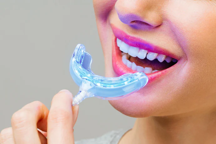 Deep Teeth Bleaching in Philadelphia, PA at Opus Dental Esthetics