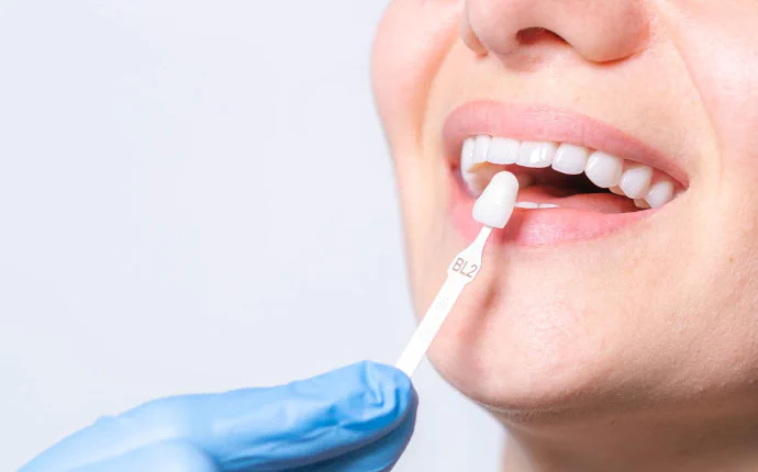 Dental veneer fitting in Philadelphia, PA at Opus Dental Esthetics