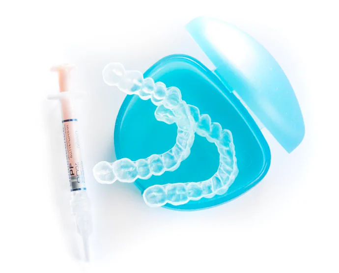 Teeth Whitening Trays in Philadelphia, PA at Opus Dental Esthetics